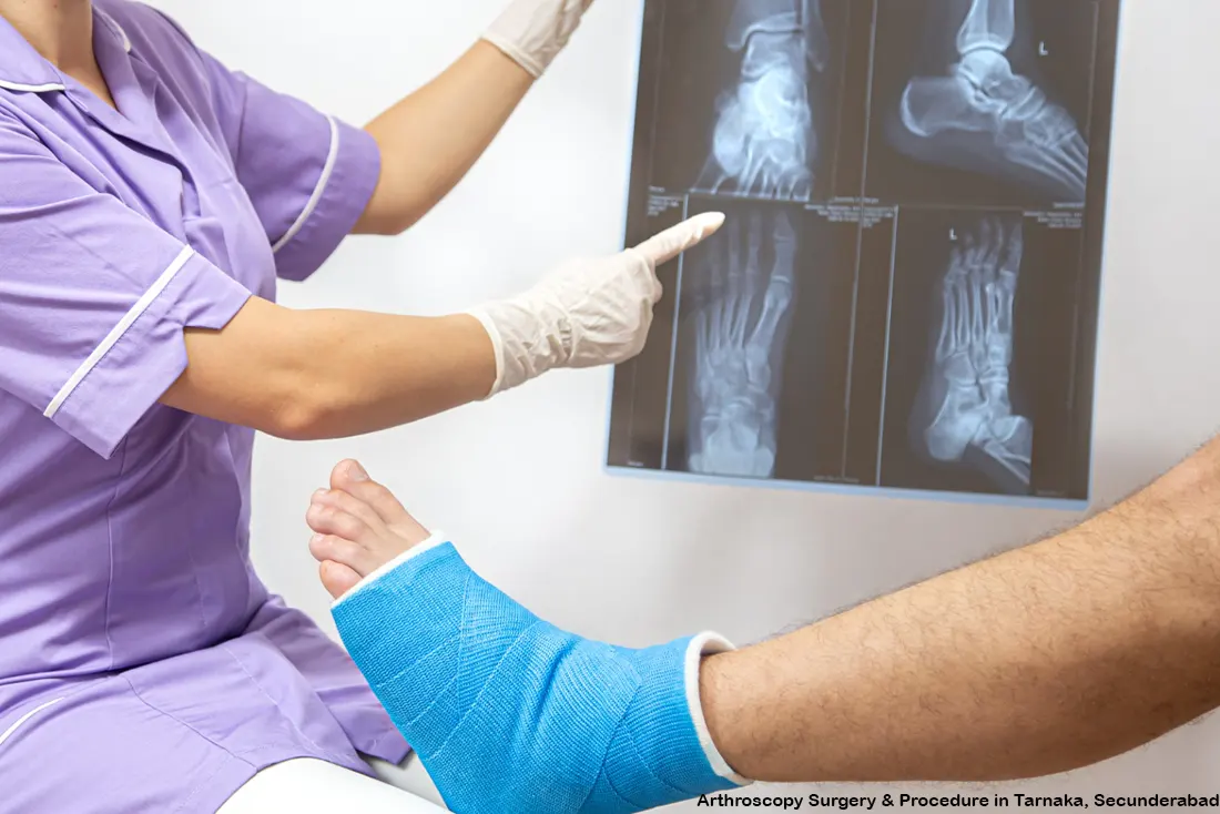 Arthroscopy Surgery & Procedure in Tarnaka, Secunderabad
