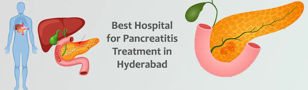 Best hospital for pancreatitis treatment in Hyderabad
