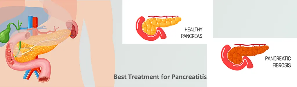 Best-Treatment-for-Pancreatitis