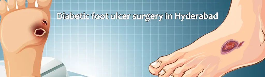 Diabetic foot ulcer surgery in Hyderabad