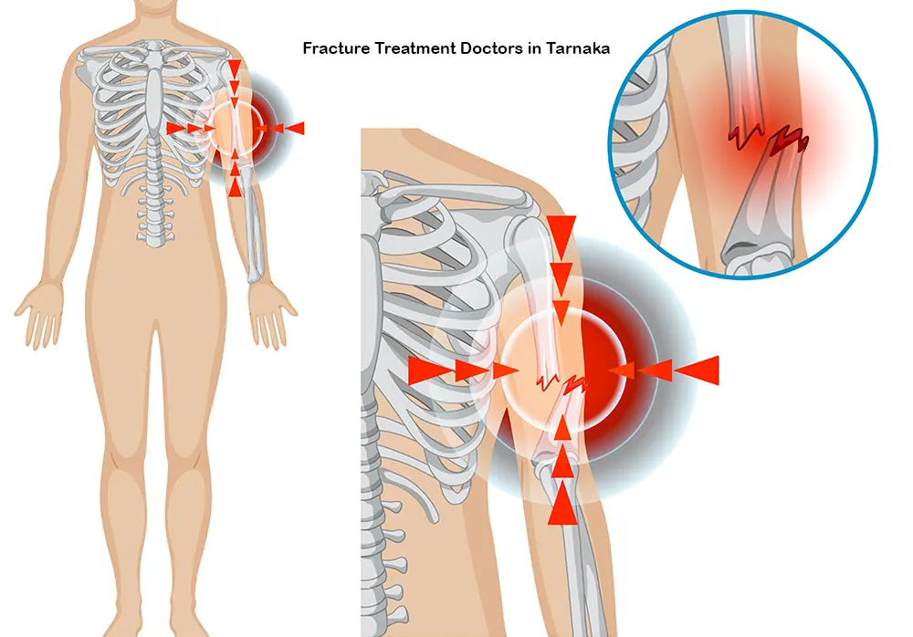 causes of fractures