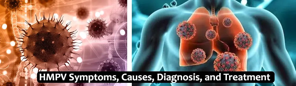 Human Metapneumovirus (HMPV): Symptoms, Causes, Diagnosis, and Treatment