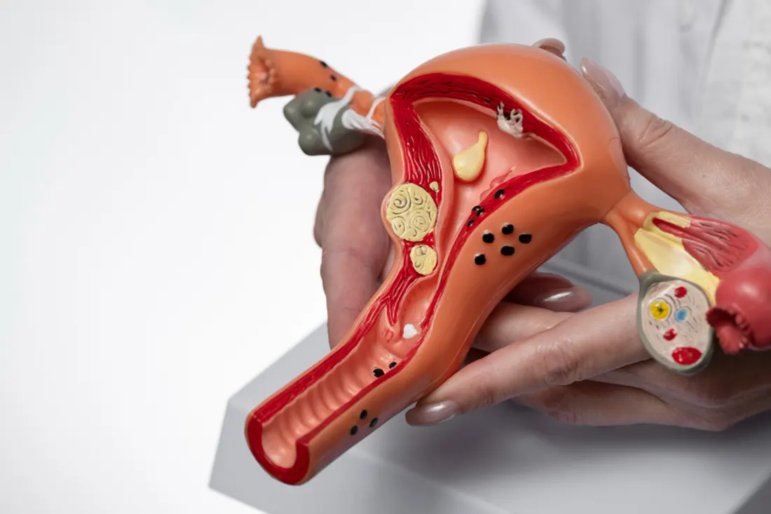 Best Hysteroscopy Hospital in Tarnaka, Secunderabad