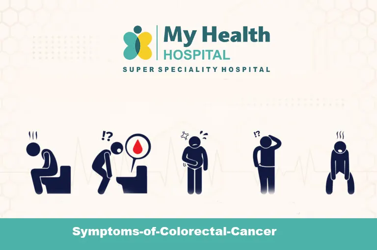 Symptoms of Colorectal Cancer