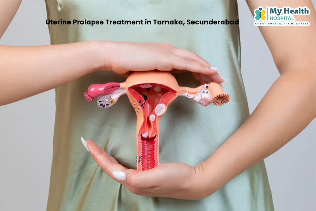 Best Uterine Prolapse Treatment in Tarnaka, Secunderabad Best Uterine Prolapse Treatment in Tarnaka, Secunderabad