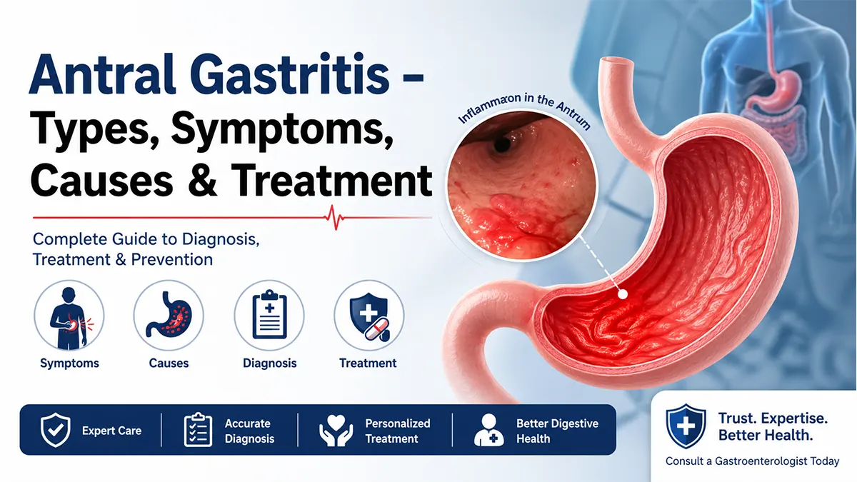 Antral gastritis illustration showing stomach inflammation with types, symptoms, causes, and treatment overview