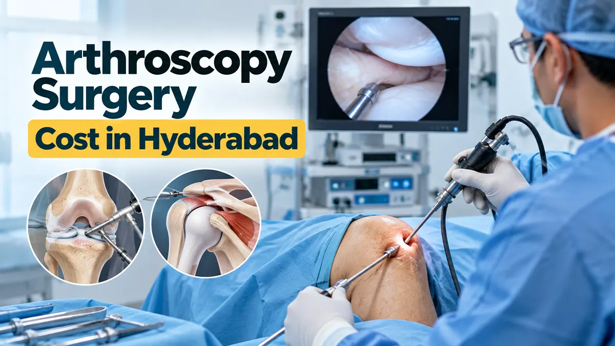 Arthroscopy surgery cost in Hyderabad for knee and shoulder procedures