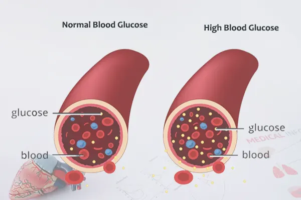 blood-glucose-levels