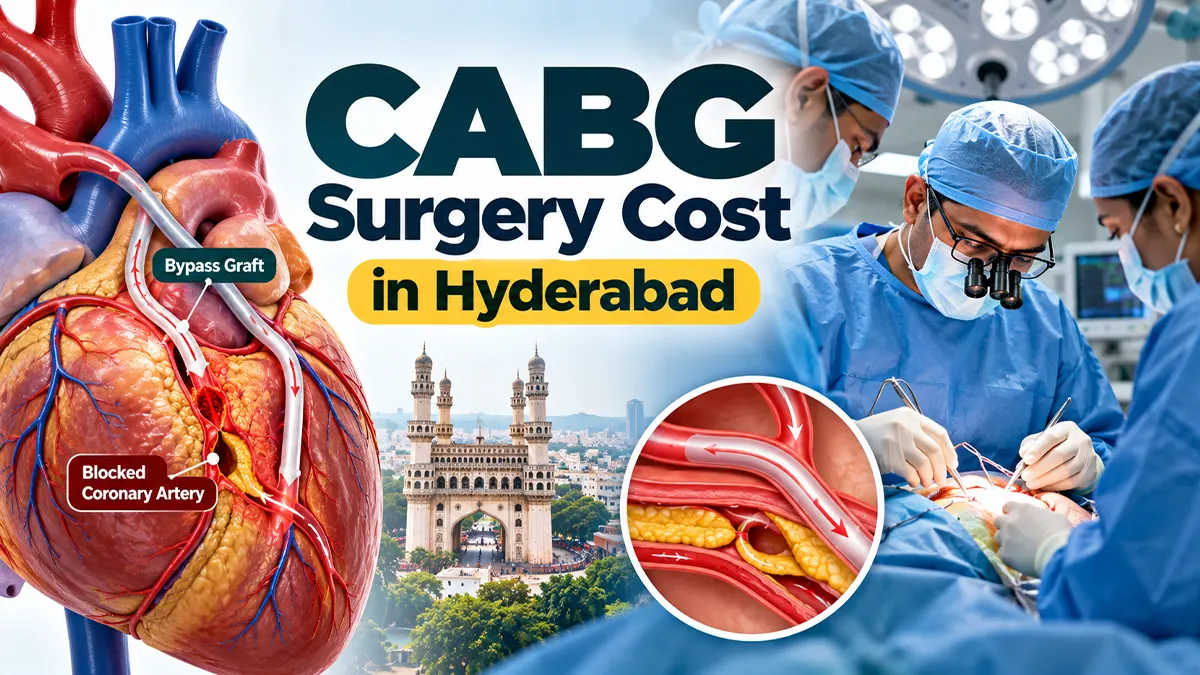 CABG coronary artery bypass grafting heart bypass surgery guide