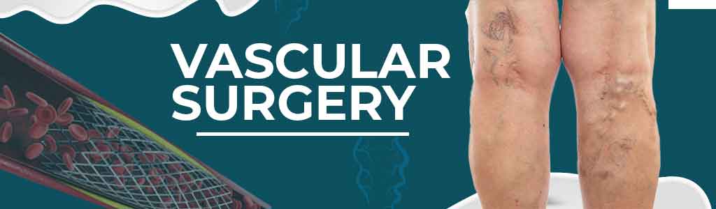 Finding the Best Vascular Surgeon