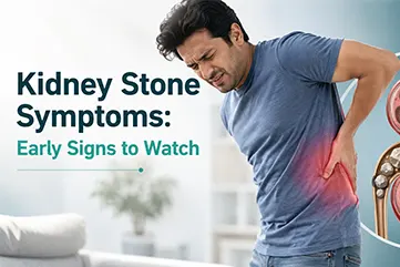 Kidney Stone Symptoms: Early Signs, Causes & Treatment