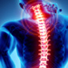 Neck Pain – Cervical Spondylosis