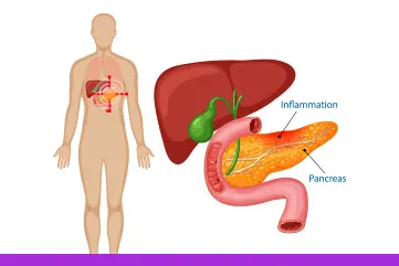 Pancreatic Cancer Awareness Month 2025