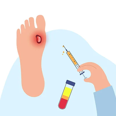 risk factors for diabetic foot ulcers
