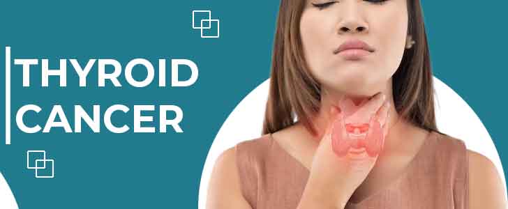 Thyroid Cancer: Symptoms, Diagnosis, Treatment, and Prognosis