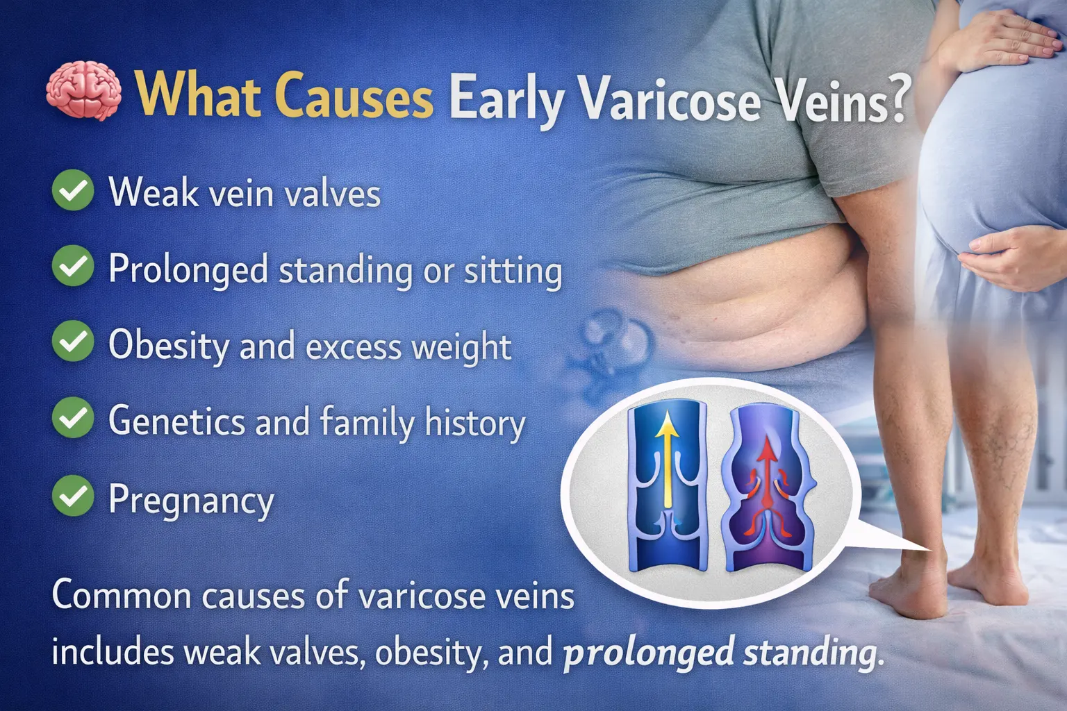 what causes early varicose veins weak valves pregnancy obesity sitting standing