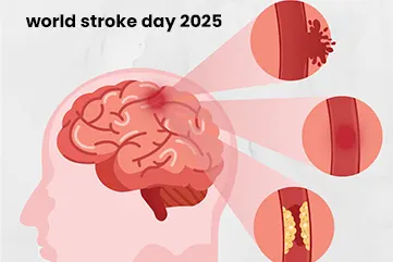 World Stroke Day 2025 – Every Minute Counts