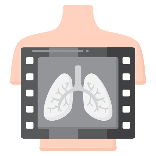 X-Ray